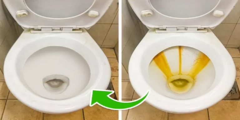 Une Astuce Pour Enlever Le Calcaire Du Fond Des Toilettes Sans Trop D ...